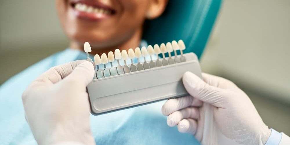 Close-up of dentist chooses right shade of implants during dental appointment with female patient.