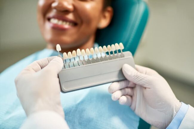 Close-up of dentist chooses right shade of implants during dental appointment with female patient.